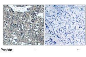 Image no. 1 for anti-Paxillin (PXN) (Tyr118) antibody (ABIN197278) (Paxillin Antikörper  (Tyr118))