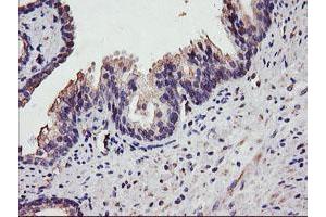 Image no. 2 for anti-Diacylglycerol Kinase, alpha 80kDa (DGKA) antibody (ABIN1497815) (DGKA Antikörper)