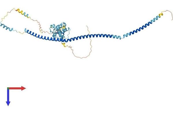 IFT57 Protein (AA 1-429) (His tag)