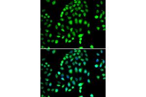 Immunofluorescence analysis of MCF-7 cells using PARP3 antibody (ABIN4904680). (PARP3 Antikörper)