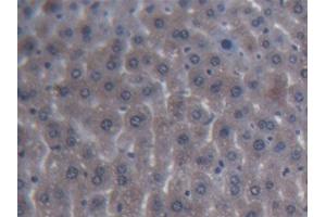 DAB staining on IHC-P; Samples: Mouse Liver Tissue (ITIH4 Antikörper  (AA 721-942))