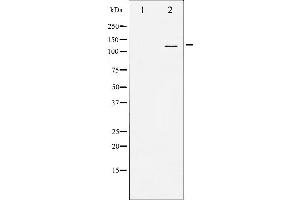 Western blot analysis of SREBP-1 expression in TNF treated JK whole cell lysates,The lane on the left is treated with the antigen-specific peptide. (SREBF1 Antikörper)