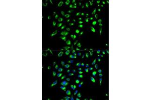 Immunofluorescence analysis of MCF-7 cell using CD86 antibody. (CD86 Antikörper  (AA 30-247))