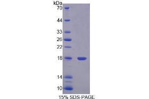 Image no. 1 for Esophageal Cancer Related Gene 4 (AA 32-148) protein (His tag) (ABIN4991011)