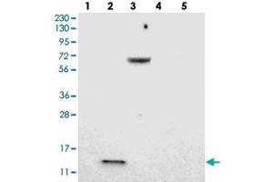 Western blot analysis of Lane 1: RT-4, Lane 2: U-251 MG, Lane 3: Human Plasma, Lane 4: Liver, Lane 5: Tonsil with LOC203547 polyclonal antibody .