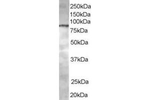 Western Blotting (WB) image for anti-ArfGAP with Coiled-Coil, Ankyrin Repeat and PH Domains 1 (ACAP1) (C-Term) antibody (ABIN2465343) (ACAP1 Antikörper  (C-Term))