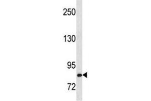 Western Blotting (WB) image for anti-Hepatocyte Growth Factor (Hepapoietin A, Scatter Factor) (HGF) (AA 521-554) antibody (ABIN3031185)