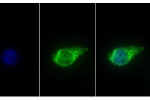 Detection of ALDH1B1 in Human HepG2 cell using Polyclonal Antibody to Aldehyde Dehydrogenase 1 Family, Member B1 (ALDH1B1) (ALDH1B1 Antikörper  (AA 18-517))