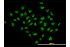 Immunofluorescence of monoclonal antibody to HDAC1 on HeLa cell. (HDAC1 Antikörper  (AA 1-482))