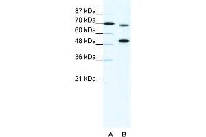 WB Suggested Anti-MLL4 Antibody Titration:  5ug/ml  Positive Control:  HepG2 cell lysate KMT2B is strongly supported by BioGPS gene expression data to be expressed in Human HepG2 cells
