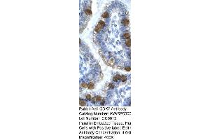 Human Intestine (CDK7 Antikörper  (C-Term))
