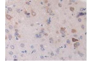 Immunohistochemistry (IHC) image for anti-Dihydrolipoamide Dehydrogenase (DLD) (AA 238-466) antibody (ABIN1858649)
