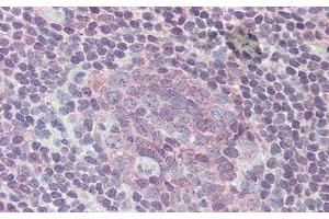 Immunohistochemistry (IHC) image for anti-Interleukin 6 Receptor (IL6R) antibody (ABIN7438385)