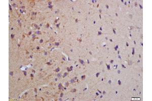 Formalin-fixed and paraffin embedded rat brain labeled with Anti-phospho-MBP(Thr232)Polyclonal Antibody, Unconjugated  at 1:200 followed by conjugation to the secondary antibody and DAB staining (MBP Antikörper  (pThr232))