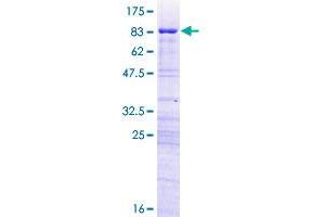 Image no. 1 for Ribosomal RNA Processing 8 (RRP8) (AA 1-456) protein (GST tag) (ABIN1308572) (RRP8 Protein (AA 1-456) (GST tag))