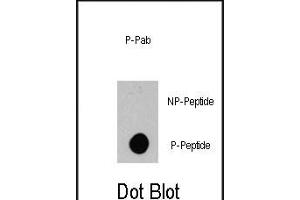 Dot blot analysis of anti-BRAF-p Phospho-specific Pab (ABIN389803 and ABIN2839698) on nitrocellulose membrane. (BRAF Antikörper  (pSer445))