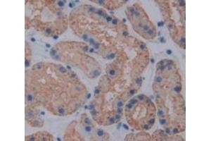 Immunohistochemistry (IHC) image for anti-Transcription Factor A, Mitochondrial (TFAM) (AA 43-246) antibody (ABIN1860701)