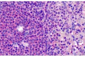 Human Tonsil: Formalin-Fixed, Paraffin-Embedded (FFPE) (CD180 Antikörper  (N-Term))