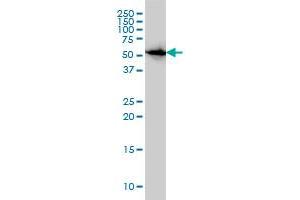 CAP1 monoclonal antibody (M01), clone 4A2 Western Blot analysis of CAP1 expression in HeLa . (CAP1 Antikörper  (AA 1-475))