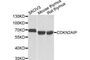Western blot analysis of extracts of various cell lines, using CDKN2AIP antibody (ABIN5971664) at 1/1000 dilution. (CDKN2AIP Antikörper)