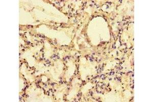 Immunohistochemistry of paraffin-embedded human lung tissue using ABIN7152273 at dilution of 1:100 (Exophilin 5 Antikörper  (AA 1235-1490))