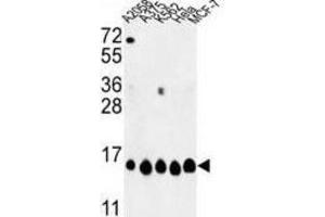 Western Blotting (WB) image for anti-Histone H2A Type 1-H (HIST1H2AH) antibody (ABIN3003926)