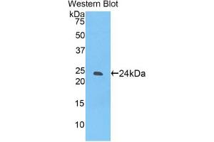 Western blot analysis of the recombinant protein. (SIGLEC12 Antikörper  (AA 22-218))