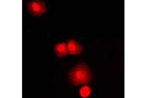 Immunofluorescent analysis of mTOR staining in MCF7 cells. (MTOR Antikörper  (C-Term))