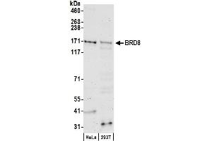 anti-Bromodomain Containing 8 (BRD8) (AA 225-275), (Isoform 2) antibody