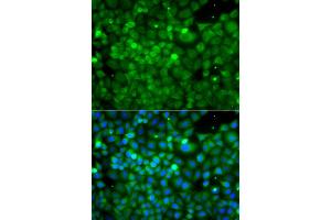 Immunofluorescence analysis of A549 cells using POC1A antibody (ABIN6293867). (POC1A Antikörper)
