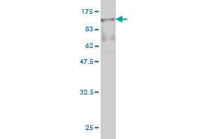Western Blot detection against Immunogen (89. (Radixin Antikörper  (AA 1-583))