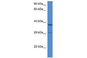Western Blot showing OGG1 antibody used at a concentration of 1 ug/ml against ACHN Cell Lysate (OGG1 Antikörper  (C-Term))
