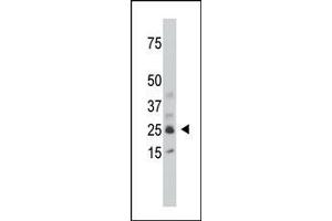 The anti-SULT1C1 Pab (ABIN389131 and ABIN2839309) is used in Western blot to detect SULT1C1 in mouse kidney tissue lysate. (SULT1C2 Antikörper  (AA 95-127))