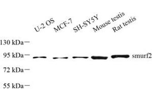 Western blot analysis of smurf2 (ABIN7075626) at dilution of 1: 500 (SMURF2 Antikörper)