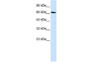 Human Daudi; WB Suggested Anti-UBP1 Antibody Titration: 0. (TFCP2 Antikörper  (Middle Region))