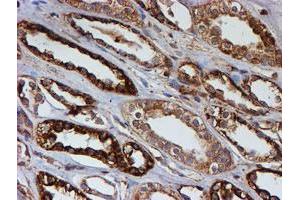 Immunohistochemical staining of paraffin-embedded Human Kidney tissue using anti-PSMB9 mouse monoclonal antibody. (PSMB9 Antikörper  (AA 21-219))