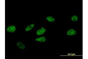 Immunofluorescence of purified MaxPab antibody to FBXO31 on HeLa cell. (FBXO31 Antikörper  (AA 1-367))