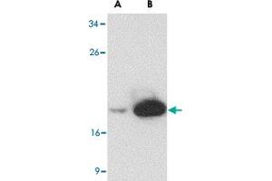 Western blot analysis of (A) 25 and (B) 125 ng of LY96 recombinant protein with LY96 monoclonal antibody, clone 9F1B1  at 1 ug/mL . (LY96 Antikörper  (AA 2-160))