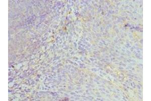 Immunohistochemistry of paraffin-embedded human tonsil tissue using ABIN7174029 at dilution of 1:100 (HCK Antikörper  (AA 1-220))