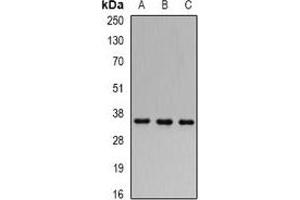 Western blot analysis of FHL-1 expression in 22RV1 (A), MCF7 (B), mouse kidney (C) whole cell lysates.