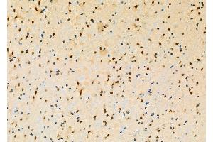 ABIN6260475 and ABIN6277853 at 1/100 staining Mouse brain tissue by IHC-P. (CASP5 Antikörper)