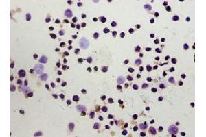 Immunohistochemistry of paraffin-embedded Hela cells using ABIN7153097 at dilution of 1:100 (FOXP3 Antikörper  (AA 1-260))
