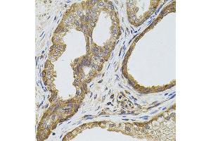 Immunohistochemistry of paraffin-embedded human prostate using EGFR antibody. (EGFR Antikörper  (AA 1021-1210))