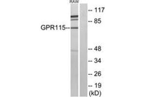 Western Blotting (WB) image for anti-G Protein-Coupled Receptor 115 (GPR115) (AA 641-690) antibody (ABIN2890790) (G Protein-Coupled Receptor 115 Antikörper  (AA 641-690))