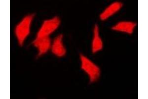 Immunofluorescent analysis of CSN1 staining in SKOV3 cells. (GPS1 Antikörper)