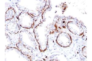 Formalin-fixed, paraffin-embedded human Prostate stained with Cytokeratin 15 Rabbit Recombinant Monoclonal Ab (KRT15/2103R). (Rekombinanter KRT15 Antikörper)