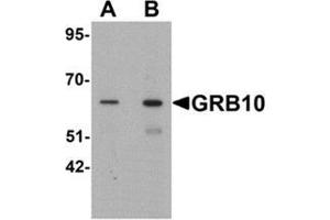 Western blot analysis of GRB10 in SK-N-SH cell lysate with GRB10 Antibody  at (A) 1 and (B) 2 µg/ml. (GRB10 Antikörper  (C-Term))