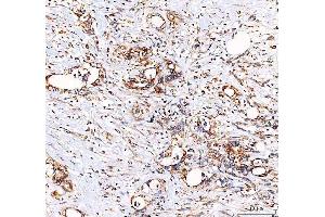 IHC analysis of EML4 using anti-EML4 antibody (ABIN6719384). (EML4 Antikörper  (AA 207-423))