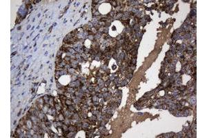 Image no. 4 for anti-NADH Dehydrogenase (Ubiquinone) 1 beta Subcomplex, 10, 22kDa (NDUFB10) antibody (ABIN1499672) (NDUFB10 Antikörper)