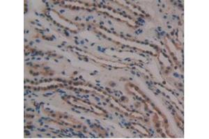 IHC-P analysis of Human Kidney Tissue, with DAB staining. (GDF3 Antikörper  (AA 251-364))